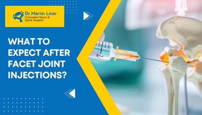 facet joint injections