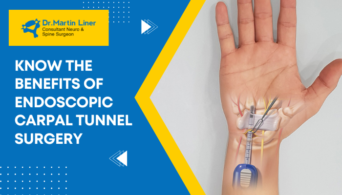 Benefits of endoscopic carpal tunnel surgery